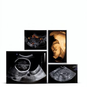 Diagnostic Sonography eBook Wolters Kluwer 5th-0